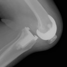 X-ray of unstable knee