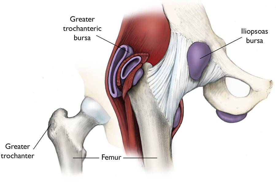 Hip Bursitis Pain Relief - Professional Physical Therapy