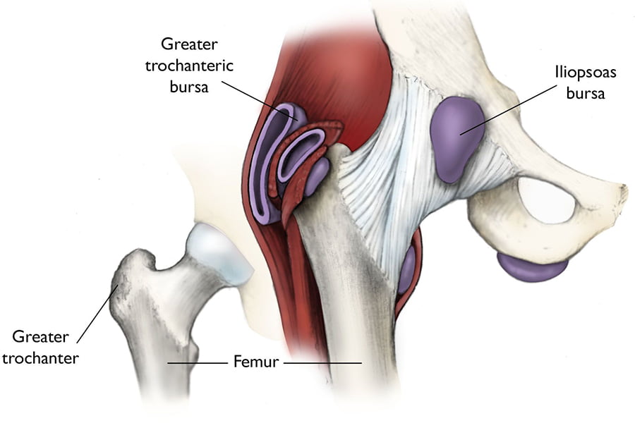 Sit Bone Pain  Ischial Bursitis Information