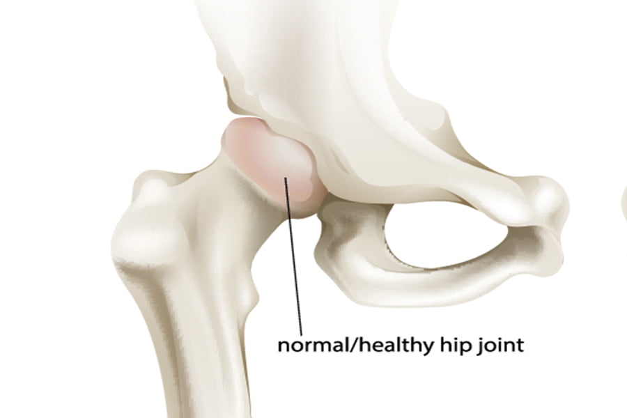 Mr Miles Callahan  Anatomy of the Hip